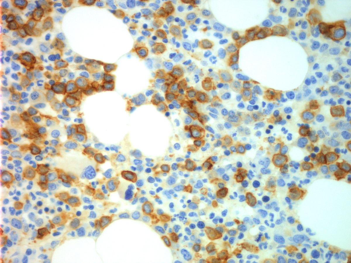 CD117 (high power)